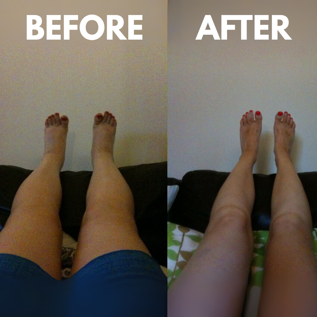 Nexark Cordless Heated Calf Massager